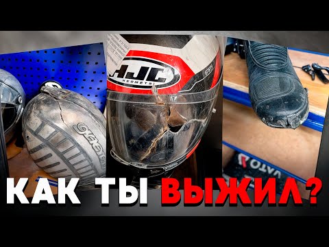 Видео: Лишился половины лица после ДТП На мотоцикле