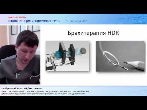 Видео: Брахитерапия в лечении локализованного РПЖ. Цыбульский А. Д.