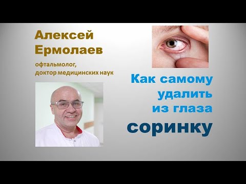 Видео: Как самому удалить попавшую в глаз соринку.  #ЛечитьсяПравильно