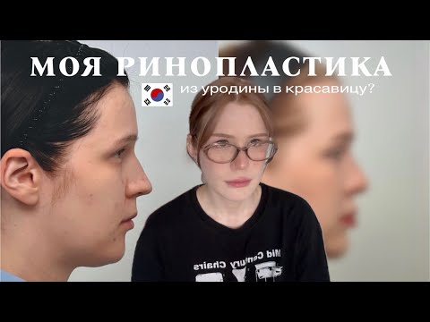 Видео: моя ринопластика в корее
