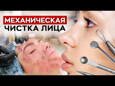 Видео: ЭТА процедура делает кожу ЧИСТОЙ! / Что такое механическая чистка лица?