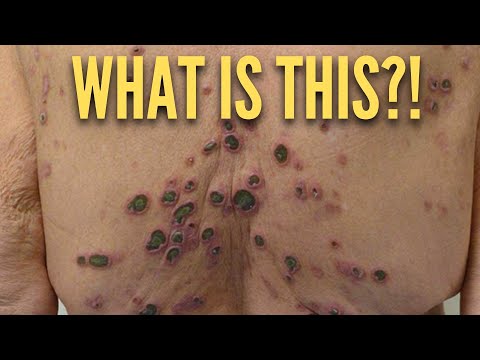 Видео: Пациент с неожиданными результатами