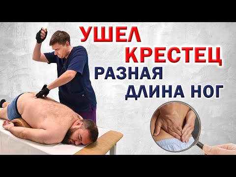 Видео: Правка крестца, устранение проблемы разной длины ног. Костоправ Александр Ферштат