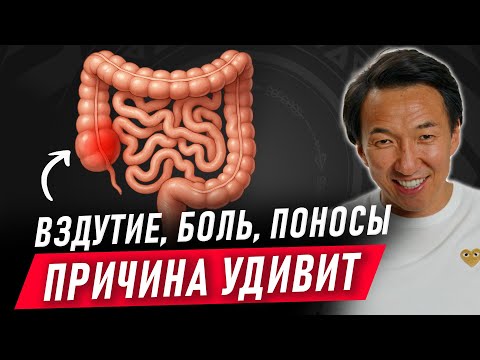Видео: СРК: каждый 7-ой человек страдает ЭТИМ РАССТРОЙСТВОМ... // #докторжимба