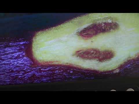 Видео: Ворог номер один в саду і на винограднику під мікроскопом