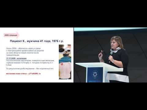 Видео: Меланома. Разбор клинических случаев. Кл. случай 2