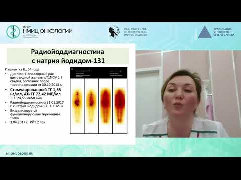 Видео: Роль радиойодтерапии в лечении рака щитовидной железы
