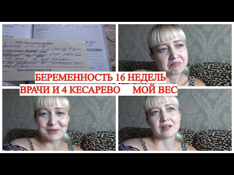 Видео: БЕРЕМЕННОСТЬ 16 НЕДЕЛЬ🤰 УЗИ👀 ЦЕРВИКОМЕТРИЯ 💑УЗНАЛА ПОЛ РЕБЁНКА 😡ВРАЧИ АТАКУЮТ