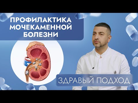 Видео: Профилактика мочекаменной болезни | Здравый подход (2024)