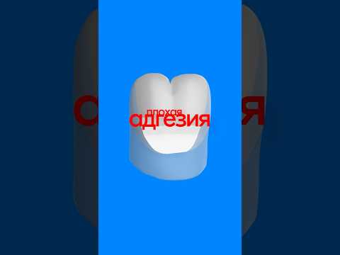 Видео: Изолирующие прокладки