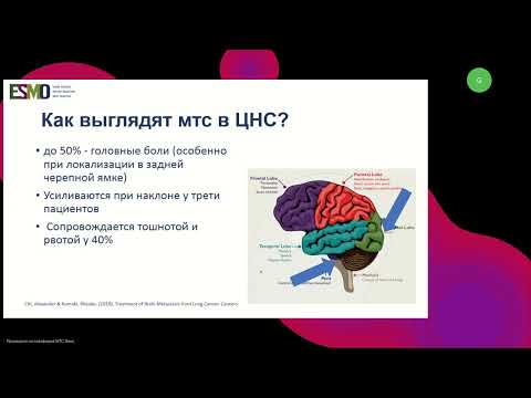 Видео: Подготовка к экзамену ESMO. Опухоли ЦНС (вебинар 25 августа 2024)