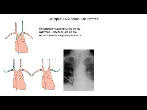 Видео: Урок №4