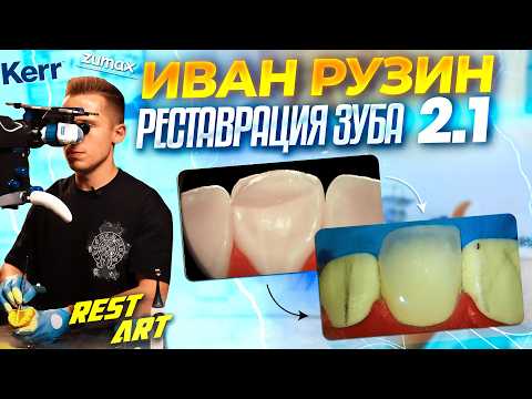 Видео: Реставрация зуба 2.1 - Иван Рузин | RestART