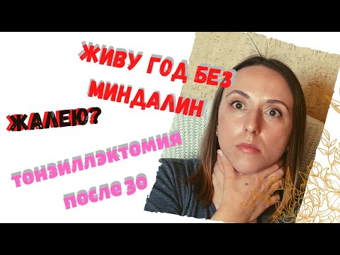 Видео: Тонзиллэктомия по ОМС: причины, как проходила, последствия
