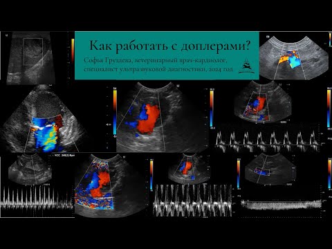 Видео: Как работать с доплерами? Цветной, энергетический, импульсно-волновой, постоянно-волновой, тканевой