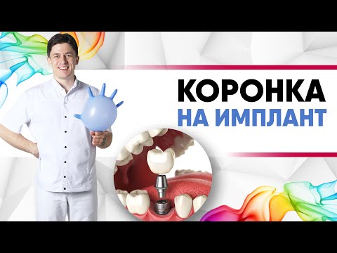 Видео: Коронка на имплант [цирконий, имакс / e.max, металлокерамика]. Винтовая / цементируемая фиксация.