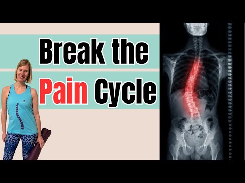 Видео: Что делать, если боль от сколиоза не проходит