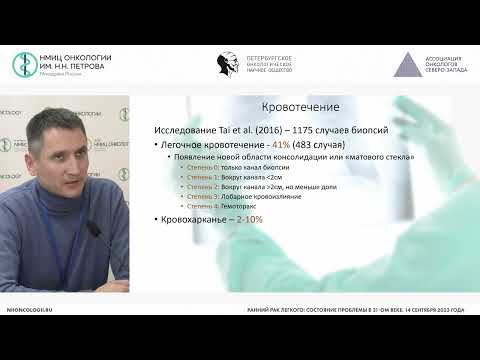 Видео: Трансторакальная биопсия легкого - что важно знать