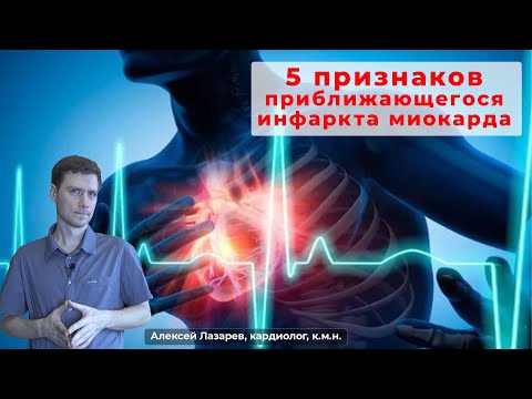 Видео: 5 ПРИЗНАКОВ ПРИБЛИЖАЮЩЕГОСЯ ИНФАРКТА МИОКАРДА #инфаркт #признакиинфаркта #ДокторАлексейЛазарев