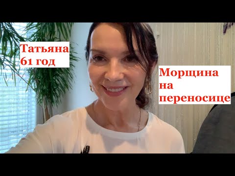 Видео: Лоб падает на переносицу? Морщина на переносице? Исправляем при помощи простой техники.