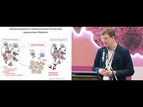 Видео: Ингибиторы контрольных точек иммунитета в лечении ЗНО. Карцинома Меркеля