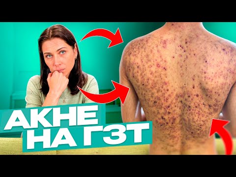 Видео: Акне на ГЗТ