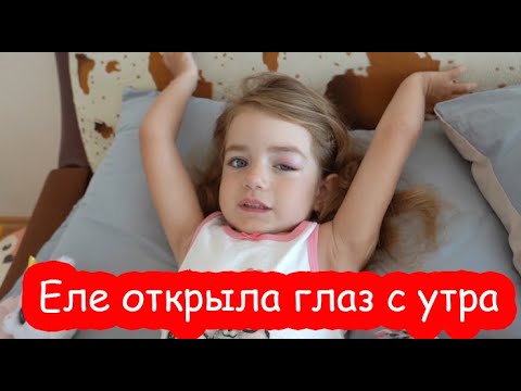 Видео: VLOG С глазиком ещё хуже. Приехала крестная мама