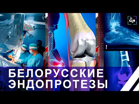 Видео: Белорусские врачи начали устанавливать отечественные эндопротезы коленного сустава. Панорама