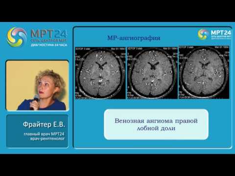 Видео: «Диагностические находки в практике врача МРТ (нейрососудистая патология)».