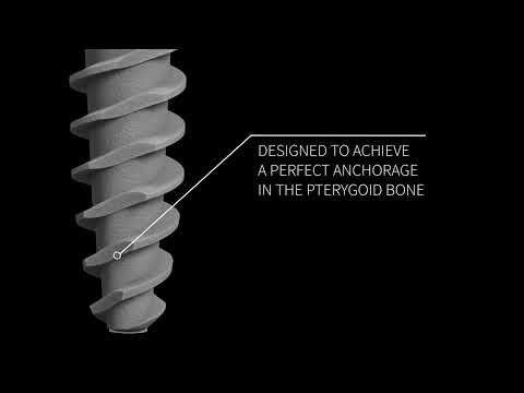 Видео: Итальянские имплантаты JD серия Pterygo One