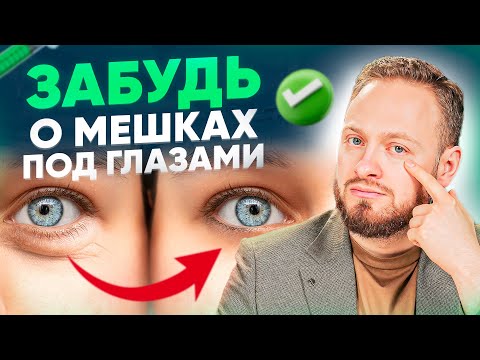 Видео: Как убрать малярные мешки и грыжи под глазами? (видео без воды)