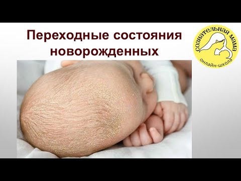 Видео: Переходные состояния новорожденных