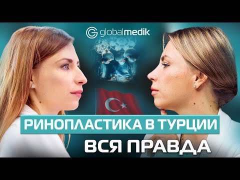 Видео: Ринопластика в Турции. Мой опыт как найти хирурга