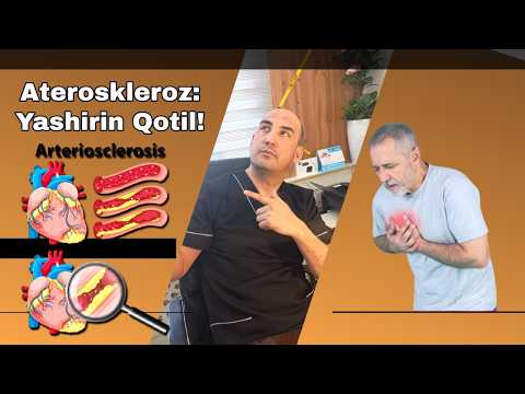 Видео: Атеросклероз яширин котил ! Ateroskieroz yashirin qotil !