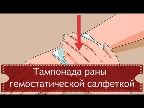 Видео: Тампонада раны гемостатической салфеткой