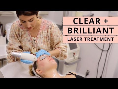 Видео: Я попробовала лазерную процедуру Clear + Brilliant