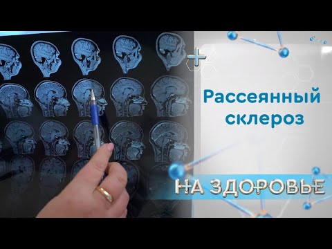 Видео: «На здоровье». Рассеянный склероз