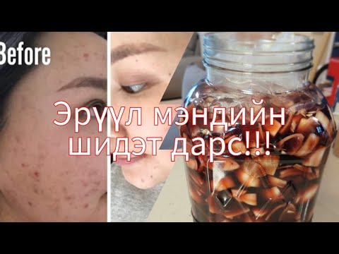 Видео: Би батганаас яаж салсан бэ? | Skincare #part1