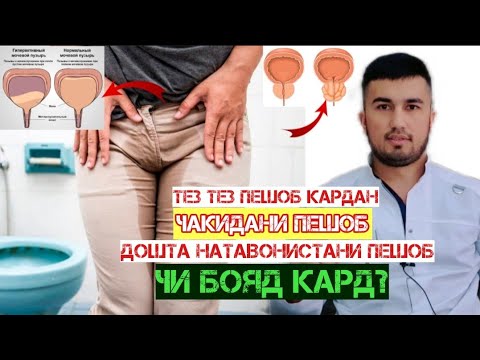 Видео: Чакидани пешоб ва тез-тез пешоб кардан аз кадом беморихо хабар медихад?