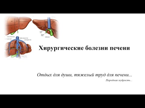 Видео: Хирургические болезни печени. Цирроз, портальная гипертензия, абсцесс, паразитарная киста печени.