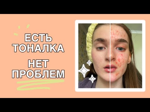 Видео: как ПРАВИЛЬНО нанести ТОН на проблемную кожу 😲 | секрет невесомого покрытия |