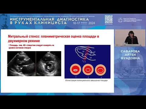 Видео: Ревматическая болезнь сердца