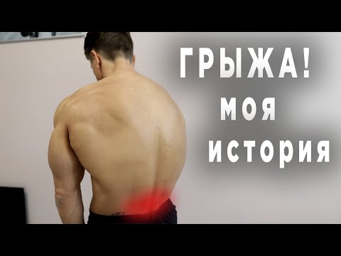 Видео: Обнаружили ПОЯСНИЧНУЮ ГРЫЖУ! Моя история + комплекс