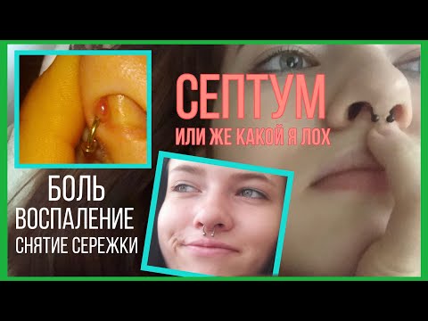 Видео: Мой септум. Прокол, боль, воспаление.