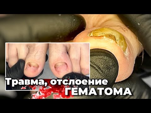 Видео: Виновата ОБУВЬ. ошибка за которую страдают ногти