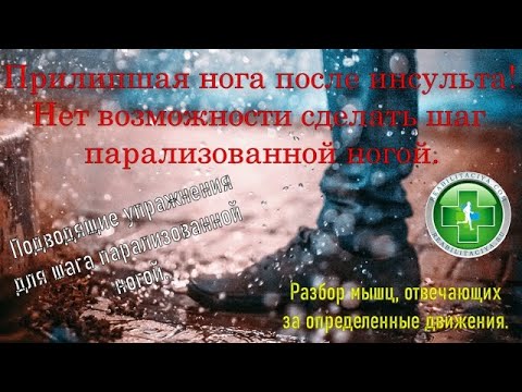 Видео: Упражнения для тренировки первого шага при парализации после инсульта.
