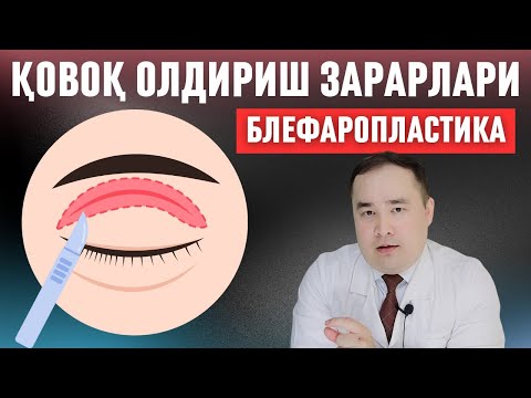 Видео: ҚОВОҚ КЕСИБ ОЛДИРИШНИ СИЗГА АЙТИЛМАЙДИГАН 7 ЗАРАРИ ҲАҚИДА ИСЧАНОВ