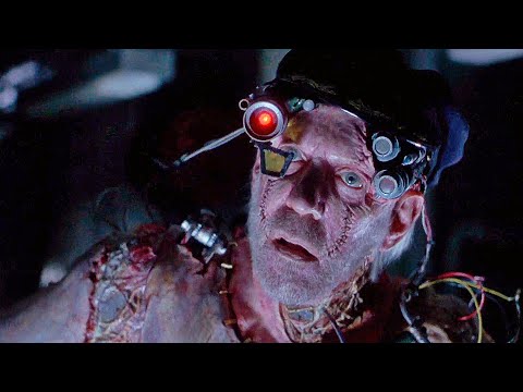 Видео: Ему вживили в тело механические детали, а он даже не понимает этого