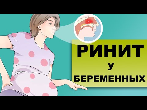 Видео: ВАЗОМОТОРНЫЙ РИНИТ У БЕРЕМЕННЫХ