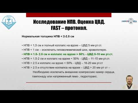 Видео: УЗИ аорты и нижней полой вены, Часть 2 / Лайков Алексей Владимирович - врач УЗИ, к.м.н.
